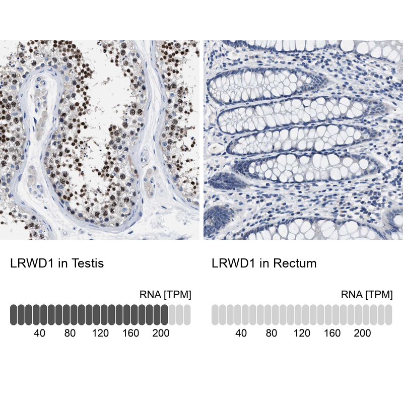 Atlas Antibodies Anti-LRWD1 Antibody