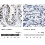 Atlas Antibodies Anti-LRWD1 Antibody
