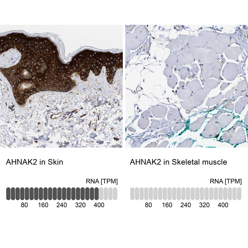 Atlas Antibodies Anti-AHNAK2 Antibody