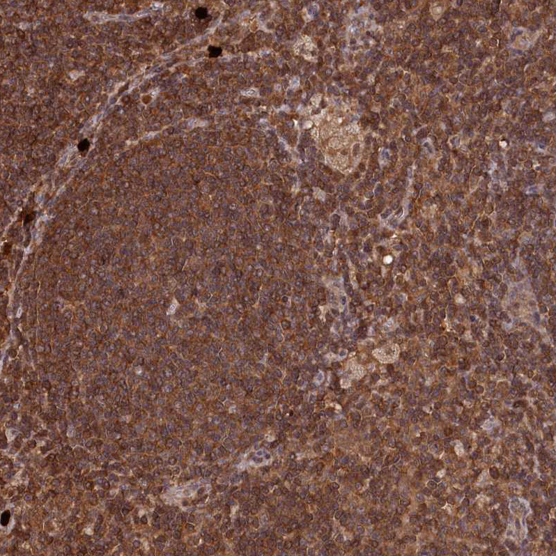 Atlas Antibodies Anti-LSG1 Antibody