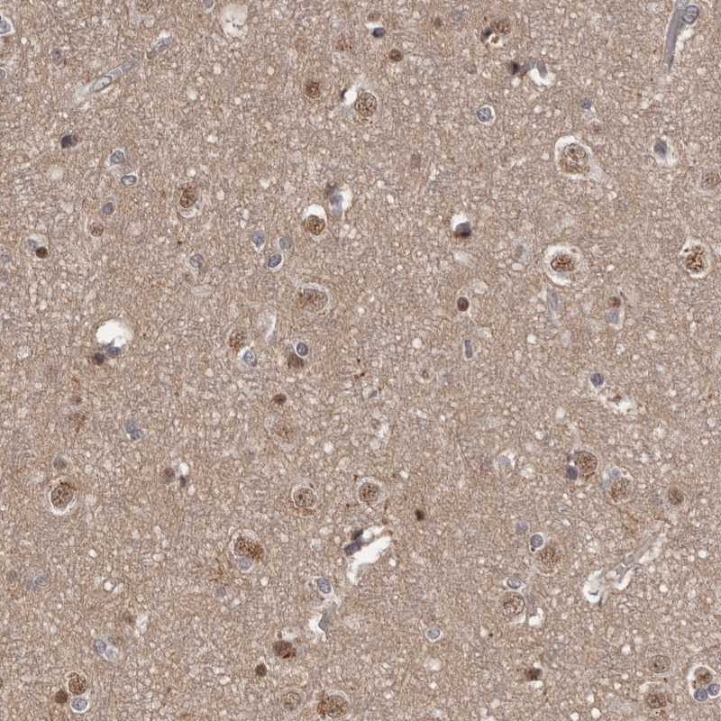 Atlas Antibodies Anti-AHR Antibody