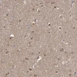 Atlas Antibodies Anti-AHR Antibody