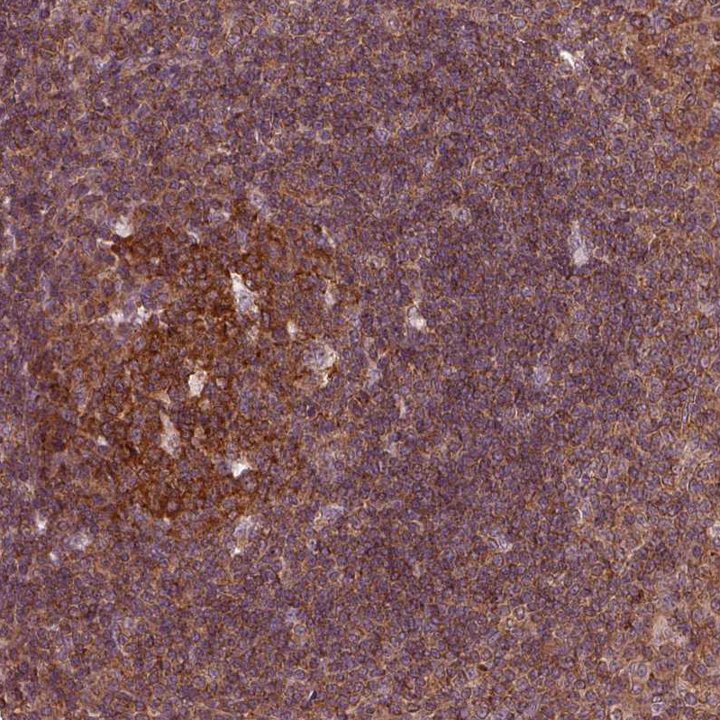 Atlas Antibodies Anti-LSM14A Antibody