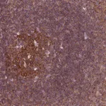 Atlas Antibodies Anti-LSM14A Antibody