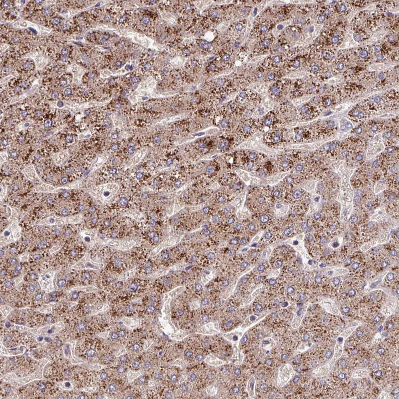 Atlas Antibodies Anti-LSM12 Antibody