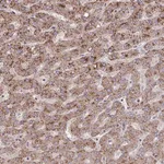 Atlas Antibodies Anti-LSM12 Antibody