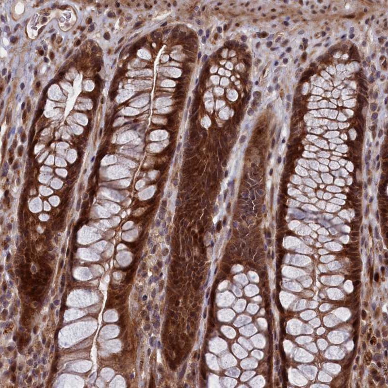 Atlas Antibodies Anti-LSG1 Antibody