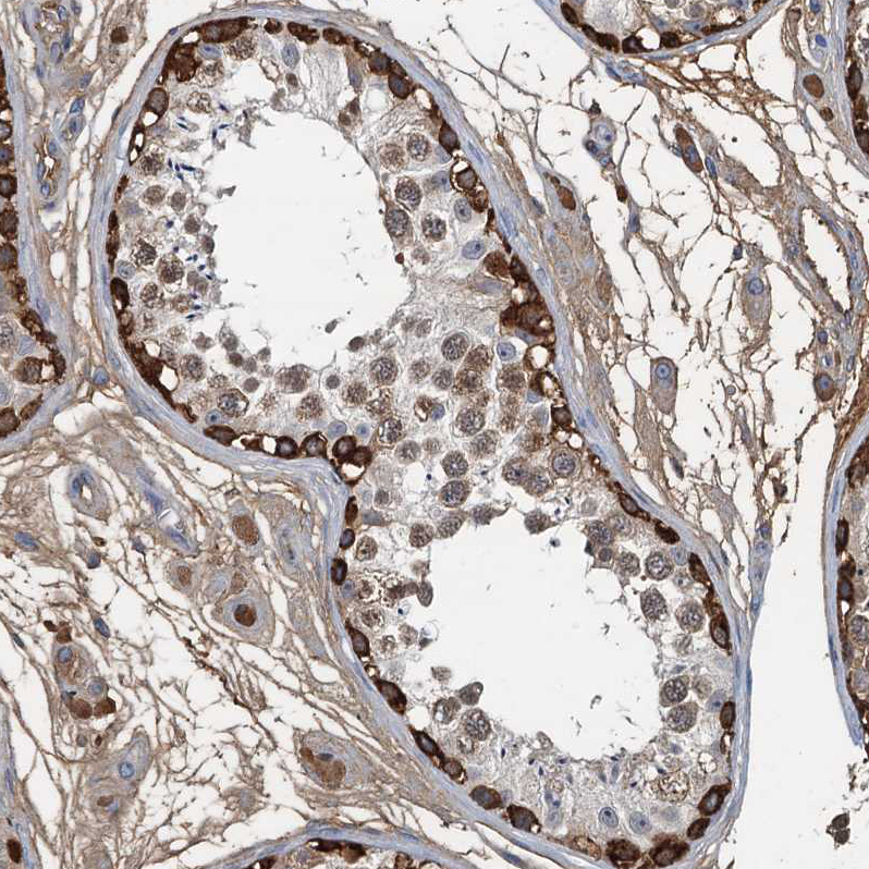 Atlas Antibodies Anti-LSM14B Antibody
