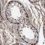 Atlas Antibodies Anti-LSM14B Antibody