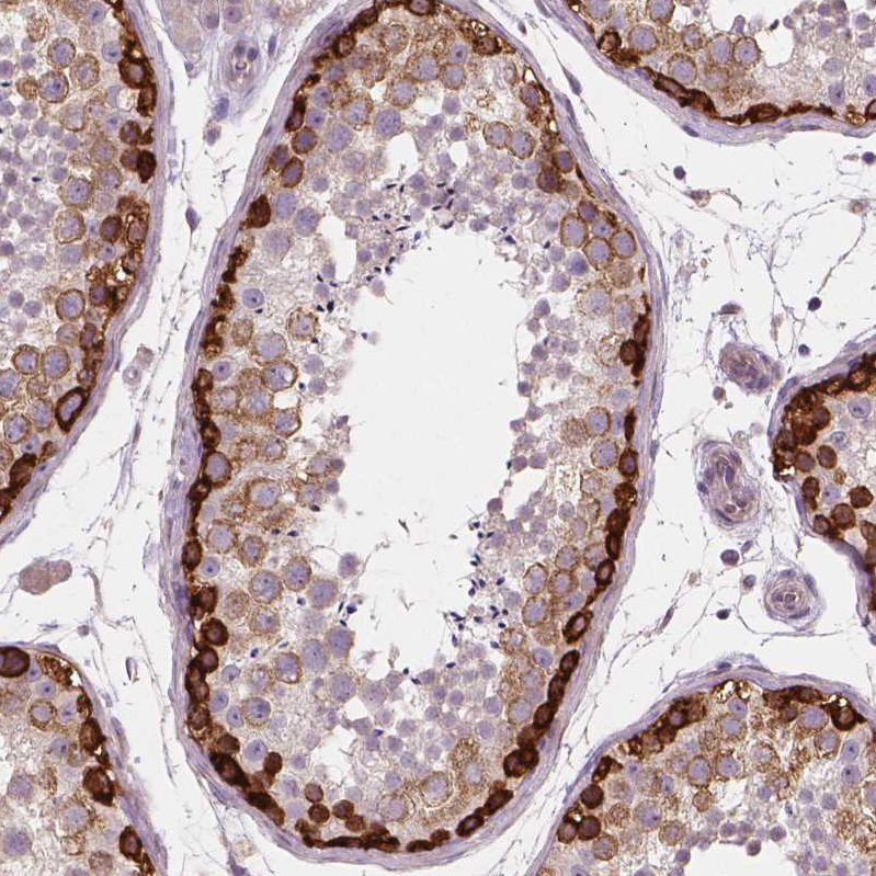 Atlas Antibodies Anti-LSM14B Antibody