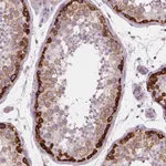 Atlas Antibodies Anti-LSM14B Antibody