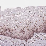 Atlas Antibodies Anti-LSM2 Antibody