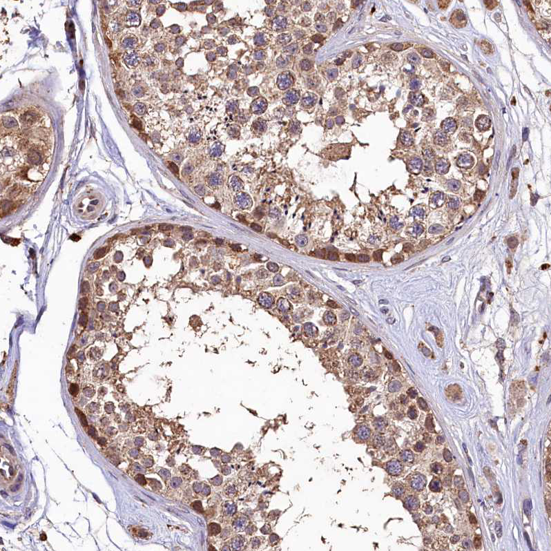 Atlas Antibodies Anti-LSM4 Antibody