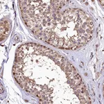 Atlas Antibodies Anti-LSM4 Antibody