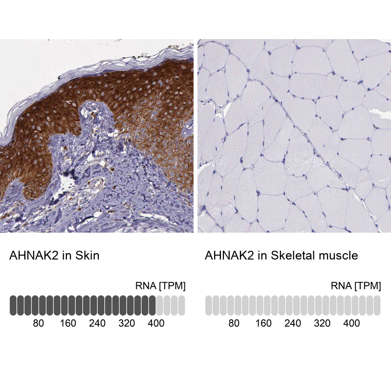 Atlas Antibodies Anti-AHNAK2 Antibody