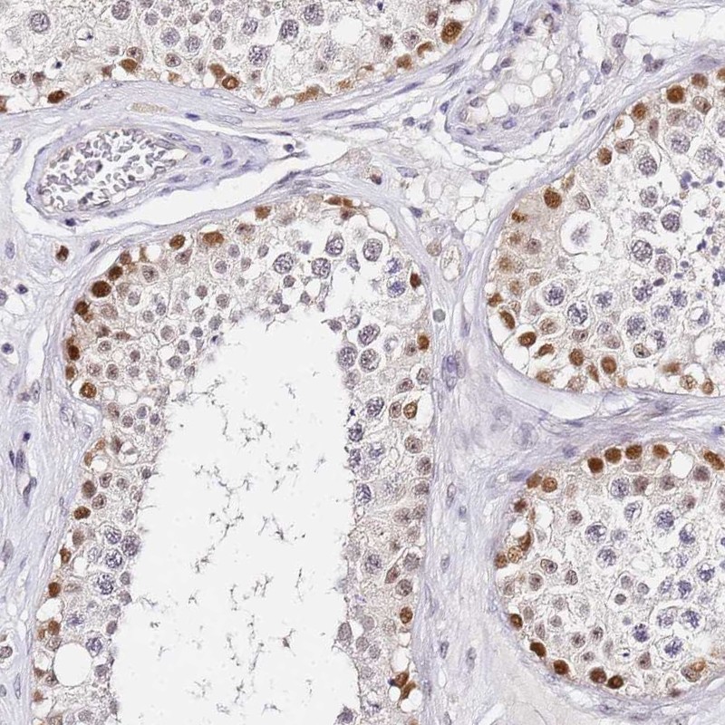 Atlas Antibodies Anti-LSM3 Antibody