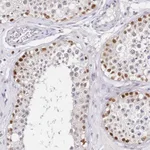 Atlas Antibodies Anti-LSM3 Antibody