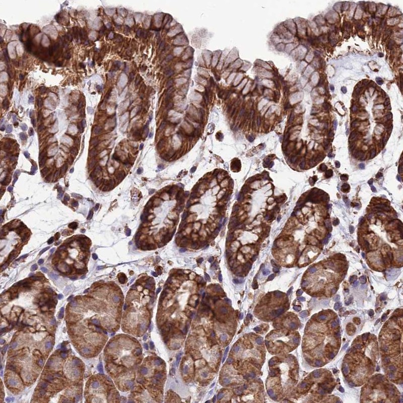 Atlas Antibodies Anti-LSM6 Antibody