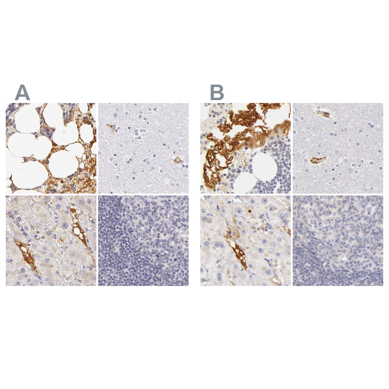 Atlas Antibodies Anti-AHSG Antibody