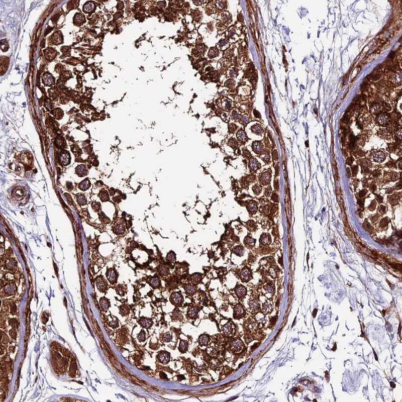 Atlas Antibodies Anti-LSM7 Antibody