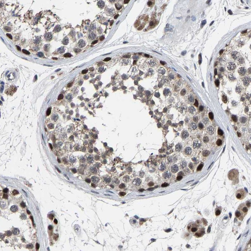 Atlas Antibodies Anti-LSM8 Antibody