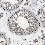 Atlas Antibodies Anti-LSM8 Antibody