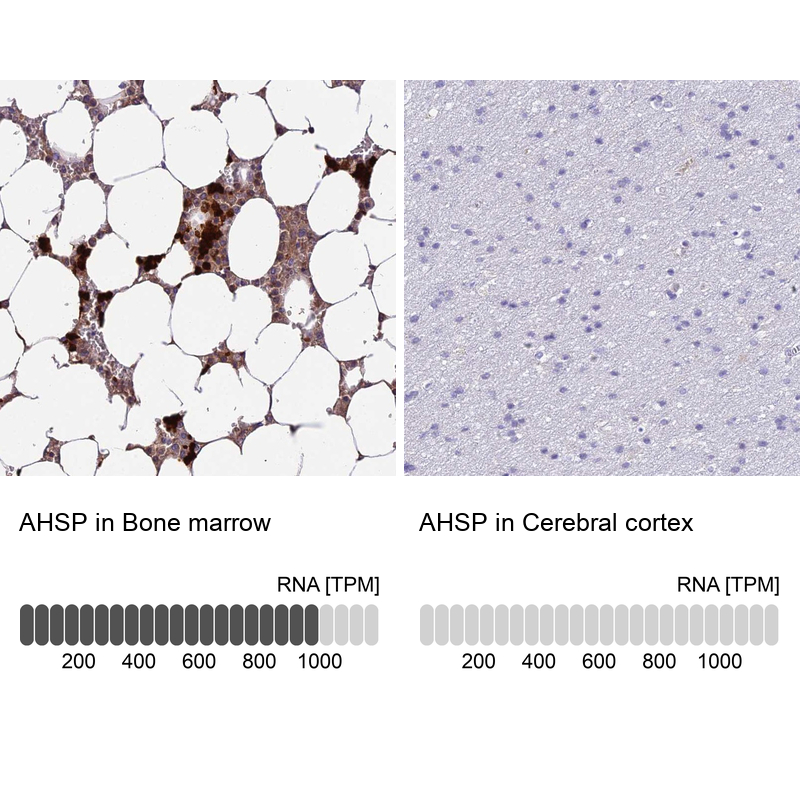 Atlas Antibodies Anti-AHSP Antibody
