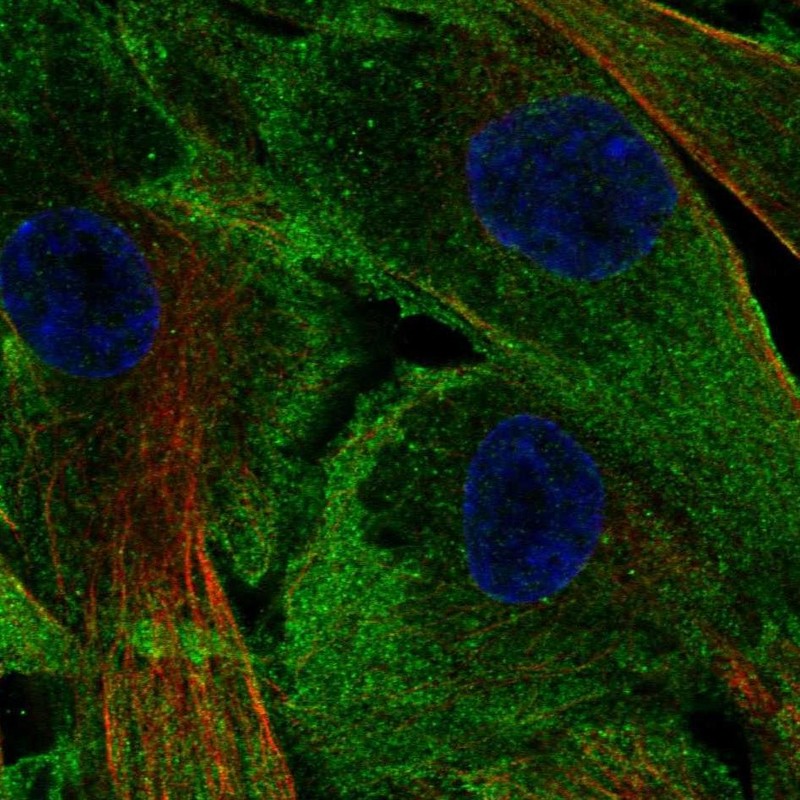 Atlas Antibodies Anti-LSP1 Antibody
