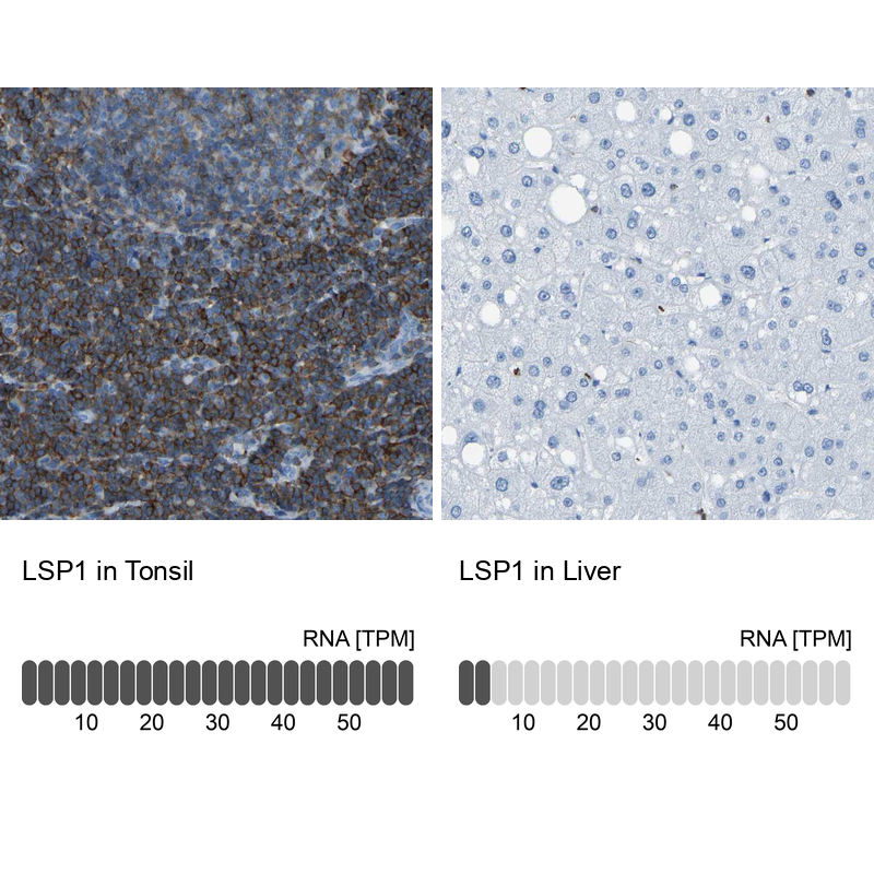 Atlas Antibodies Anti-LSP1 Antibody