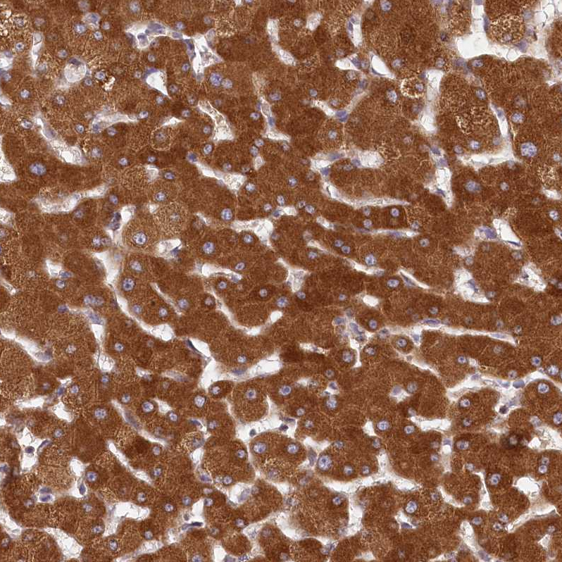 Atlas Antibodies Anti-LSS Antibody