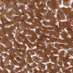 Atlas Antibodies Anti-LSS Antibody