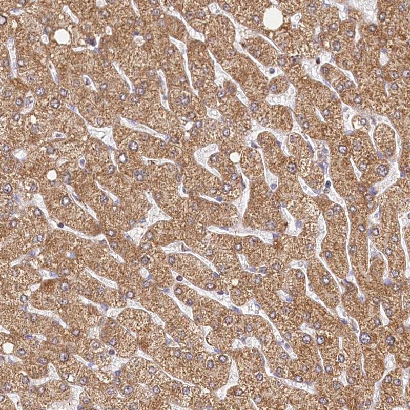Atlas Antibodies Anti-LSS Antibody