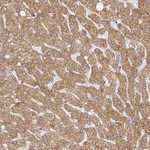 Atlas Antibodies Anti-LSS Antibody
