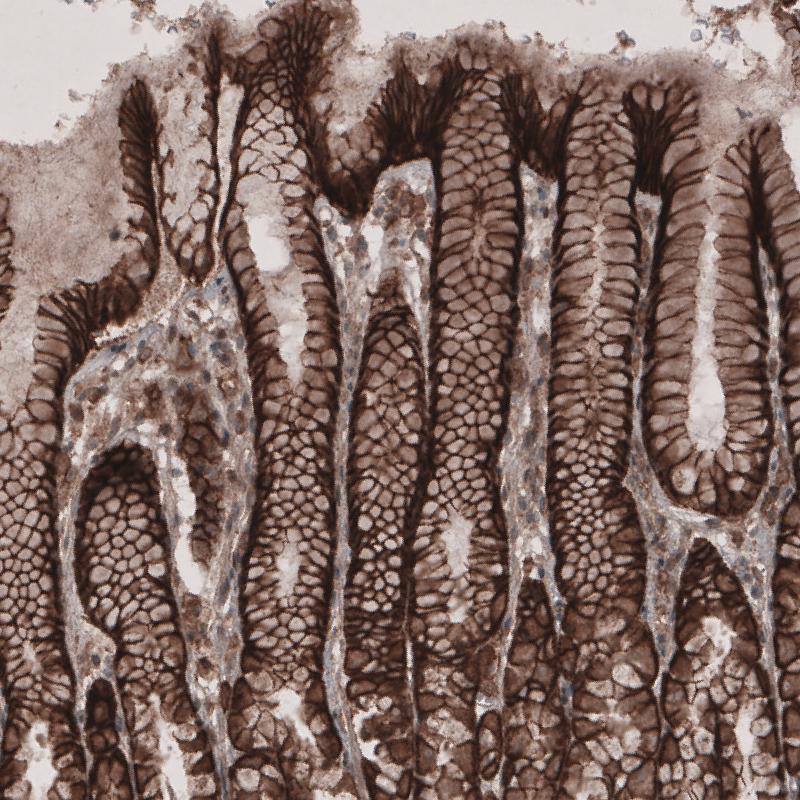 Atlas Antibodies Anti-LSR Antibody