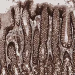 Atlas Antibodies Anti-LSR Antibody