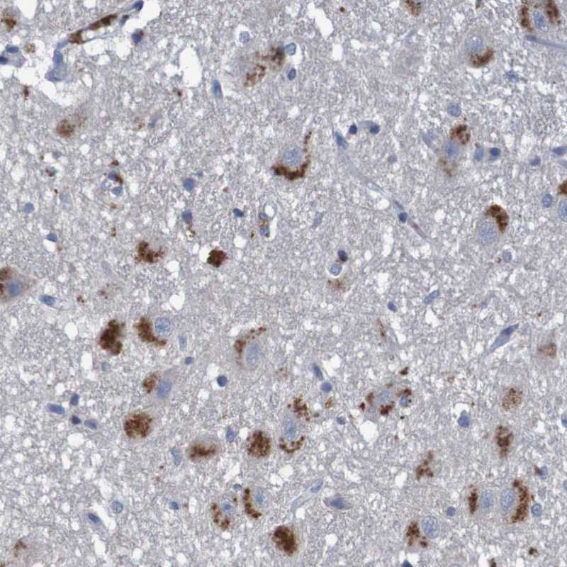 Atlas Antibodies Anti-LTA Antibody