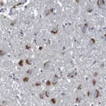 Atlas Antibodies Anti-LTA Antibody
