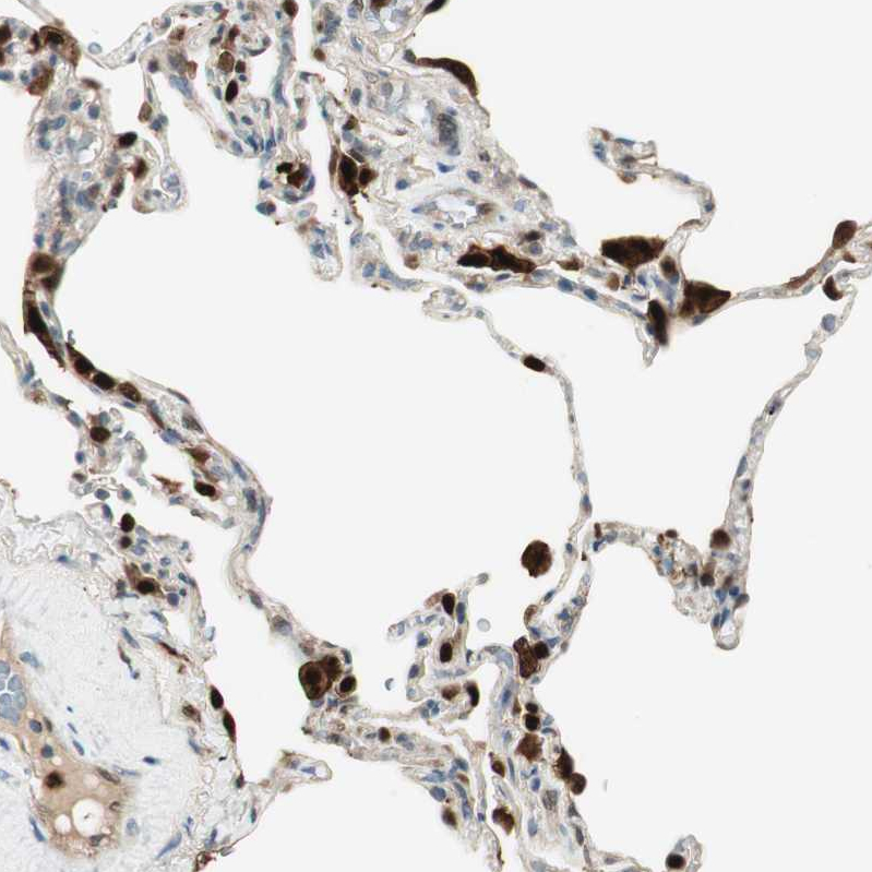 Atlas Antibodies Anti-LTA4H Antibody