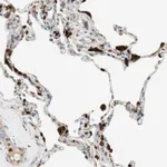 Atlas Antibodies Anti-LTA4H Antibody