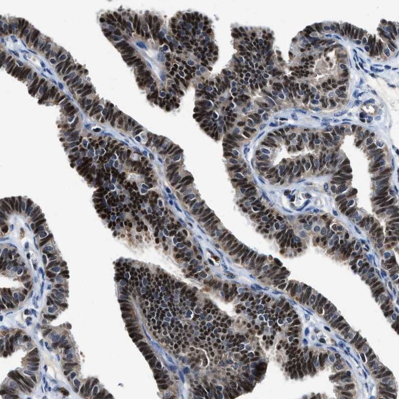 Atlas Antibodies Anti-LTA4H Antibody