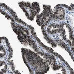 Atlas Antibodies Anti-LTA4H Antibody