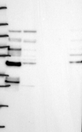 Atlas Antibodies Anti-LSR Antibody