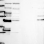 Atlas Antibodies Anti-LSR Antibody