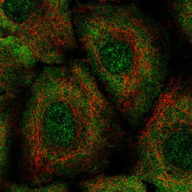 Atlas Antibodies Anti-LTB4R2 Antibody