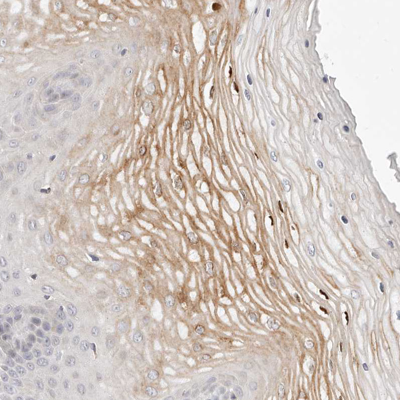 Atlas Antibodies Anti-LTB4R2 Antibody