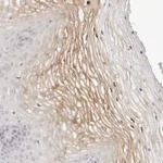 Atlas Antibodies Anti-LTB4R2 Antibody