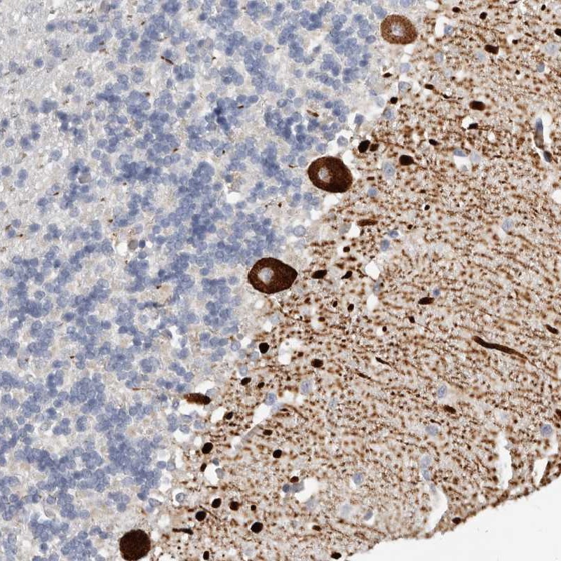 Atlas Antibodies Anti-AIDA Antibody
