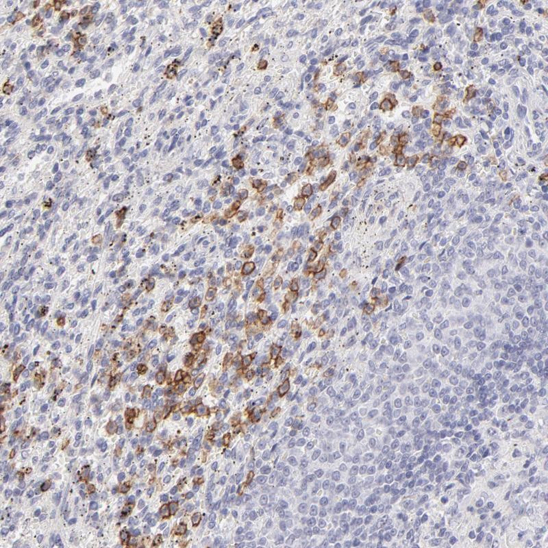 Atlas Antibodies Anti-LTB4R Antibody