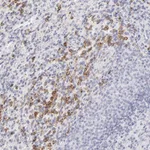Atlas Antibodies Anti-LTB4R Antibody