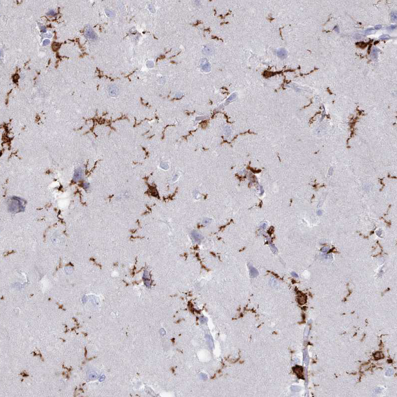 Atlas Antibodies Anti-AIF1 Antibody